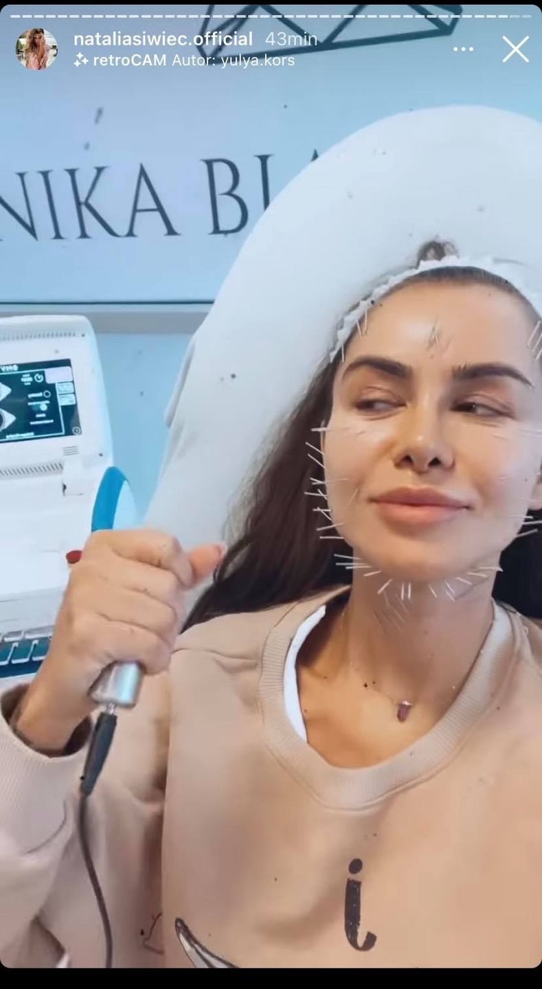 Natalia Siwiec z twarzą NAKŁUTĄ IGŁAMI relacjonuję wizytę w klinice medycyny estetycznej