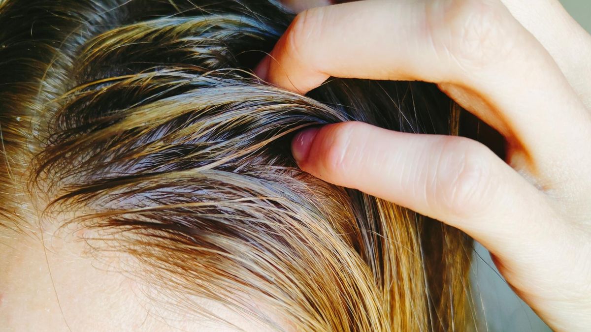 Wcierki do włosów to kosmetyk do pielęgnacji skóry głowy.