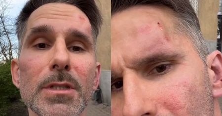 Marcin Bosak POBITY przez kierowcę z aplikacji! "Prawie przejechał mojego syna" (ZDJĘCIA)