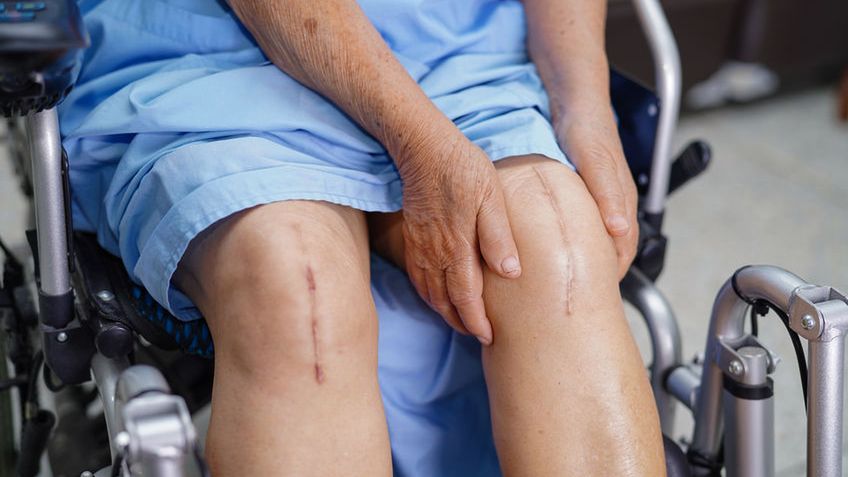 Dermatix to lek w formie maści, który stosuje się najczęściej w przypadku blizn różnego pochodzenia.