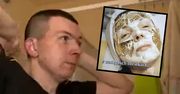Poddał się zabiegowi na twarz. Zmiany w życiu Jarusia z "Chłopaków do wzięcia"