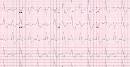 Darmowe badania EKG