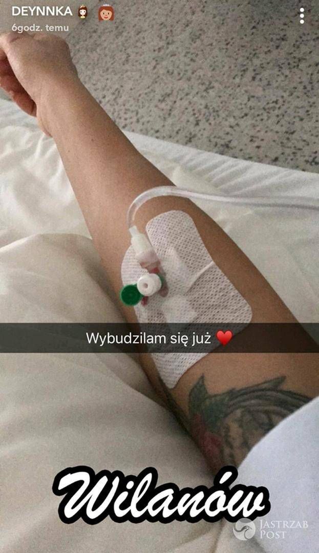 Deynn relacjonuje samopoczucie po operacji plastycznej
