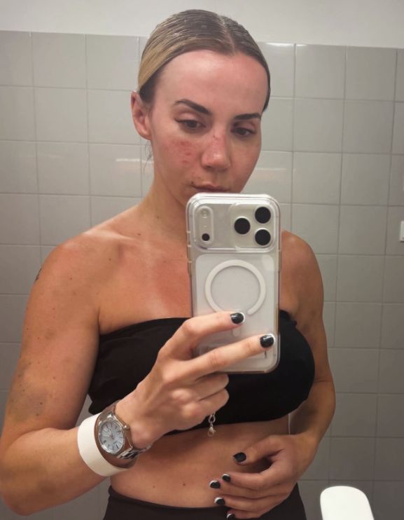 Marianna Schreiber po pojedynkach MMA