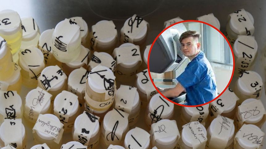 Pierwszym objawem raka pęcherza moczowego jest bezbolesny krwiomocz