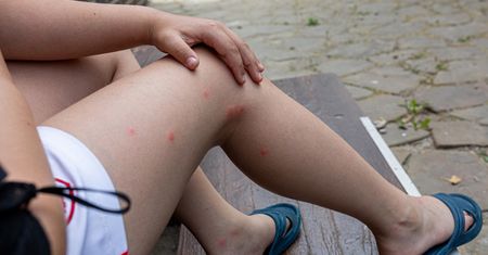 Groźny wirus w Europie. Potwierdzono 158 zakażeń nabytych lokalnie