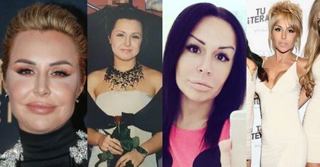 Tak zmieniała się Blanka Lipińska: Od pociesznej brunetki do blond entuzjastki medycyny estetycznej (ZDJĘCIA)