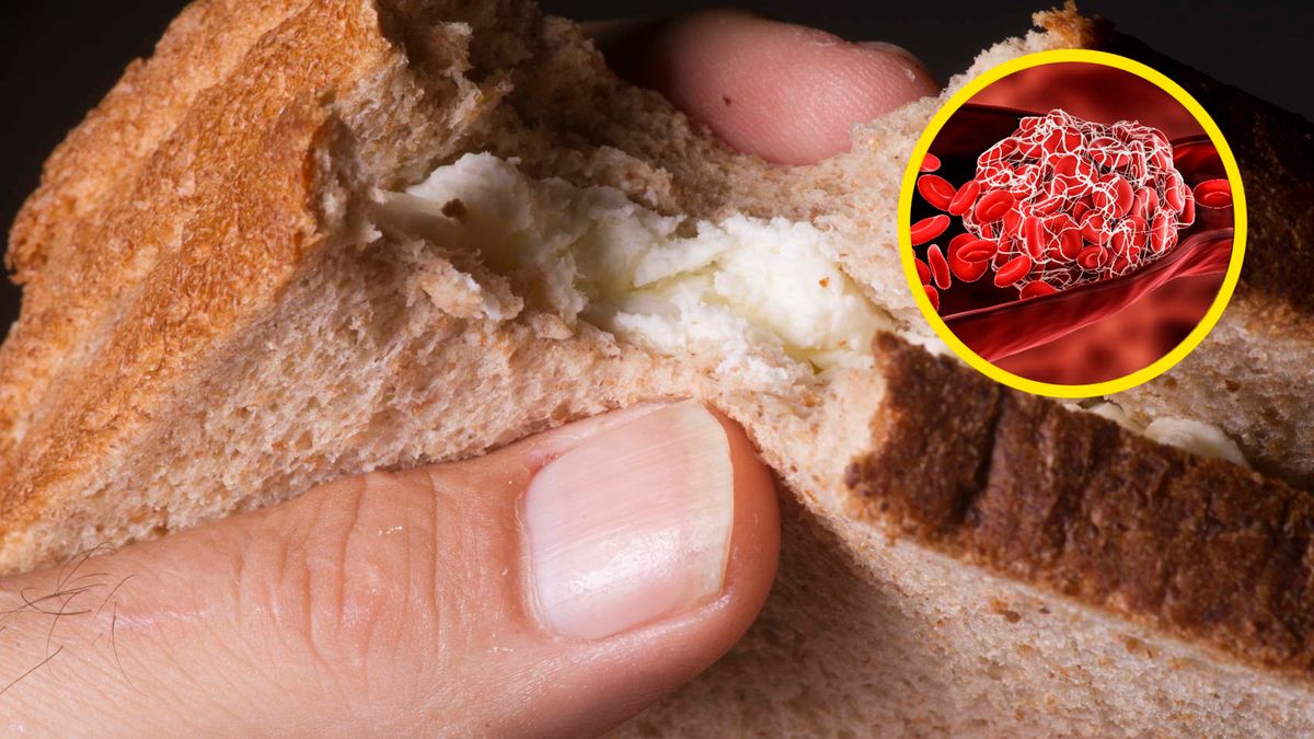 Jadasz? Uważaj. Prosta droga do zakrzepicy