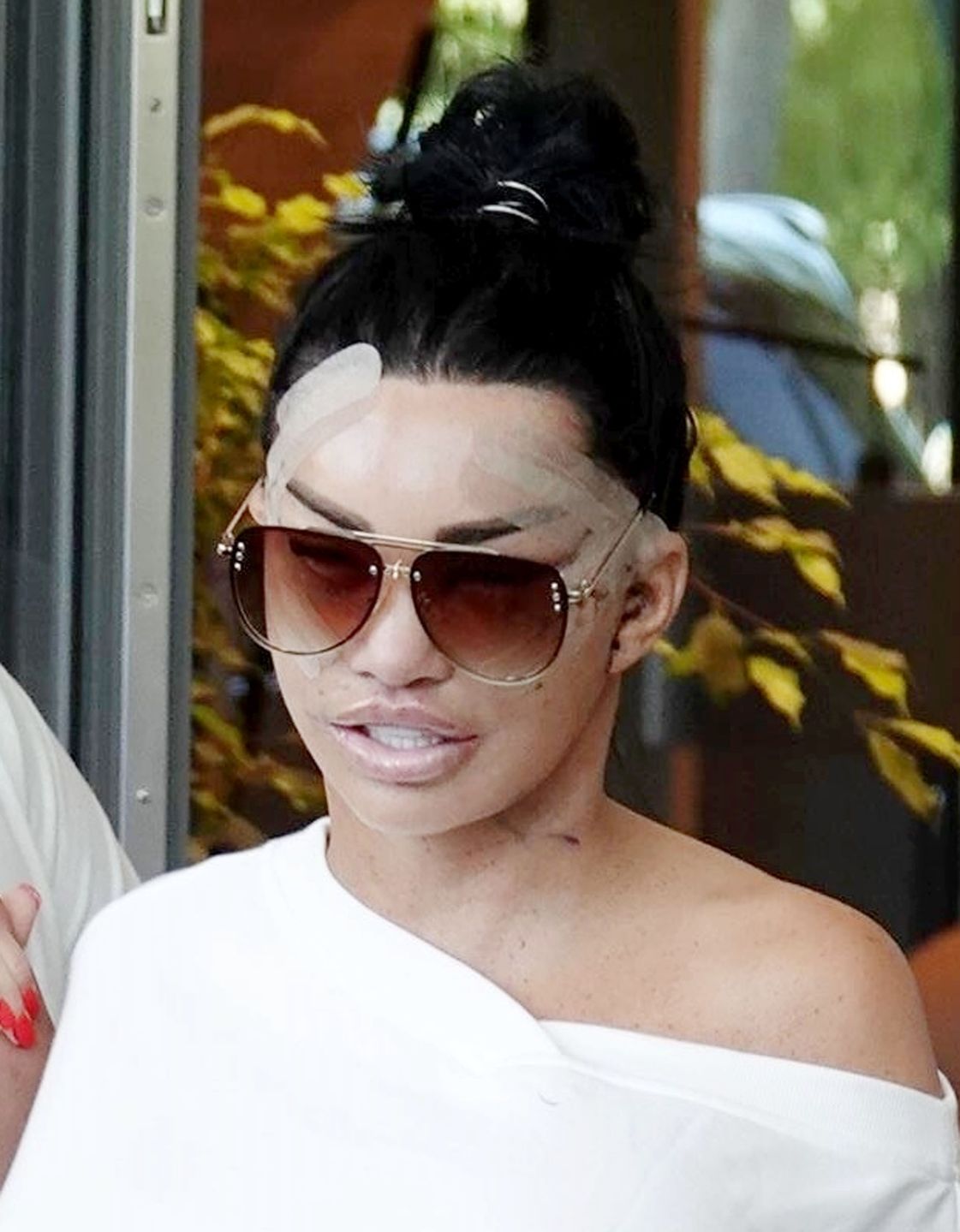 Katie Price sfotografowana tuż po wykonaniu 6. liftingu twarzy 