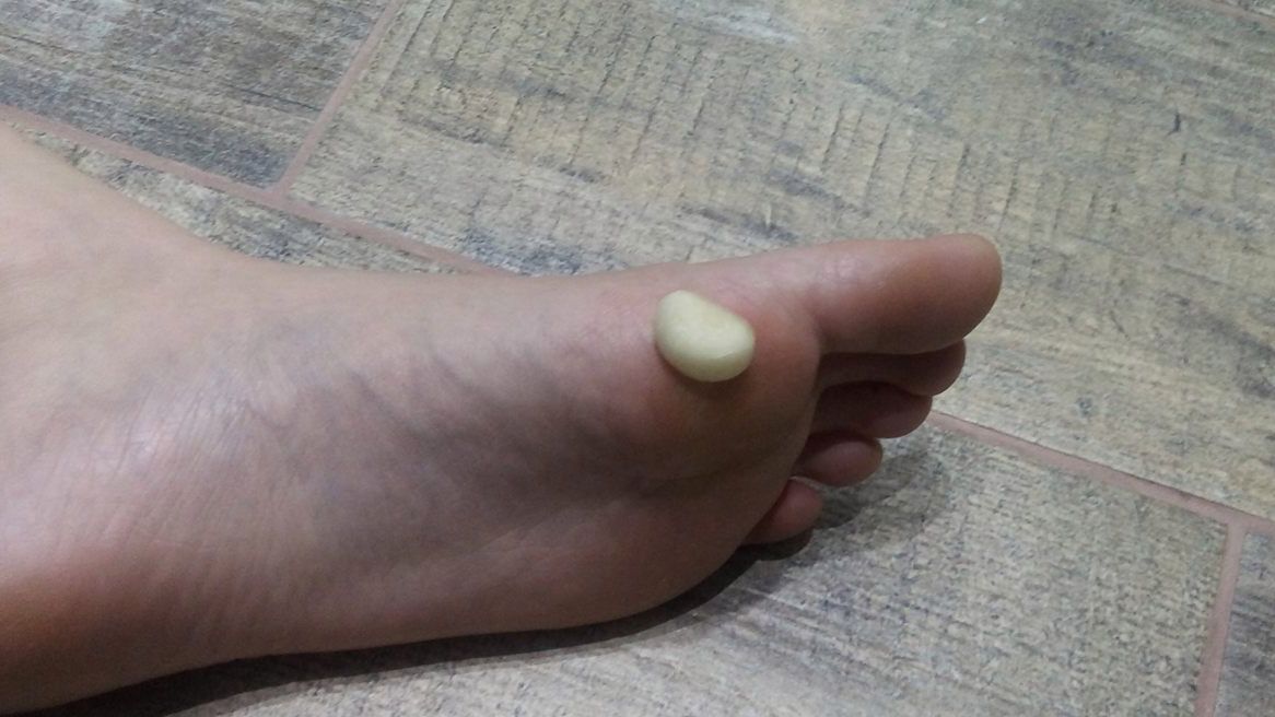 Czosnek zmiękcza skórę