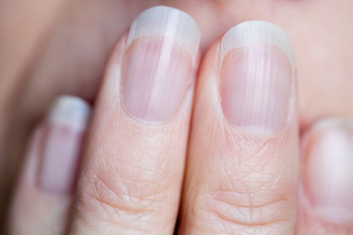 Objaw pojawia się na paznokciach. Znak, że nerki mogą być w fatalnym stanie
