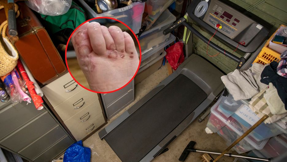 Bieżnia wciągnęła stopy rocznej dziewczynki