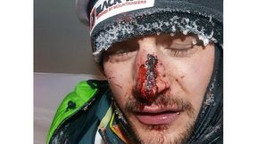 Dramatyczne zdjęcia z K2. Adam Bielecki: Było blisko!