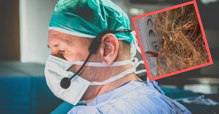 "Pół wiaderka". Lekarz pokazał, co usunęli z wraz z guzem