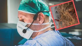 "Pół wiaderka". Lekarz pokazał, co usunęli z wraz z guzem