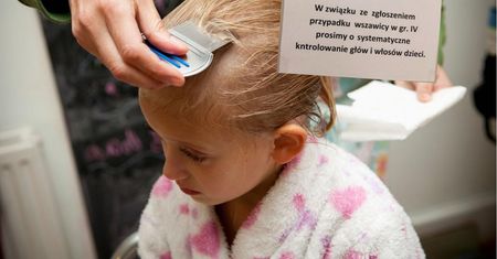 Powraca problem wszawicy. Pasożyty pojawiły się w polskich żłobkach i przedszkolach