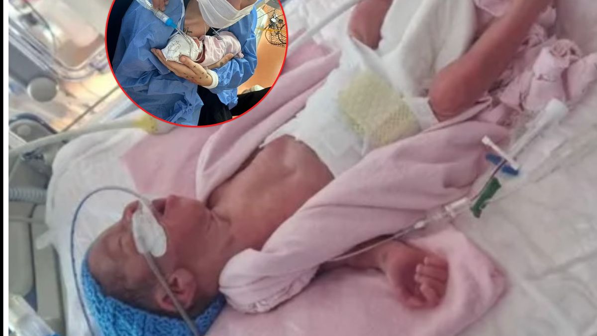 Dziecko urodziło się w 26. tygodniu.