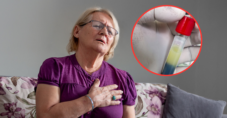 Dwa kluczowe badania po 60. roku życia. Mogą uchronić przed zawałem