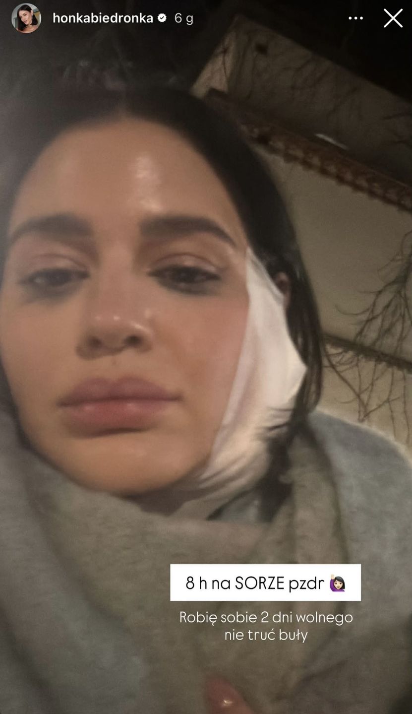 Honorata Skarbek trafiła na SOR