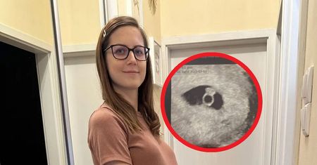 Miała nigdy nie zajść w ciążę. Ma dwie waginy i dwie macice