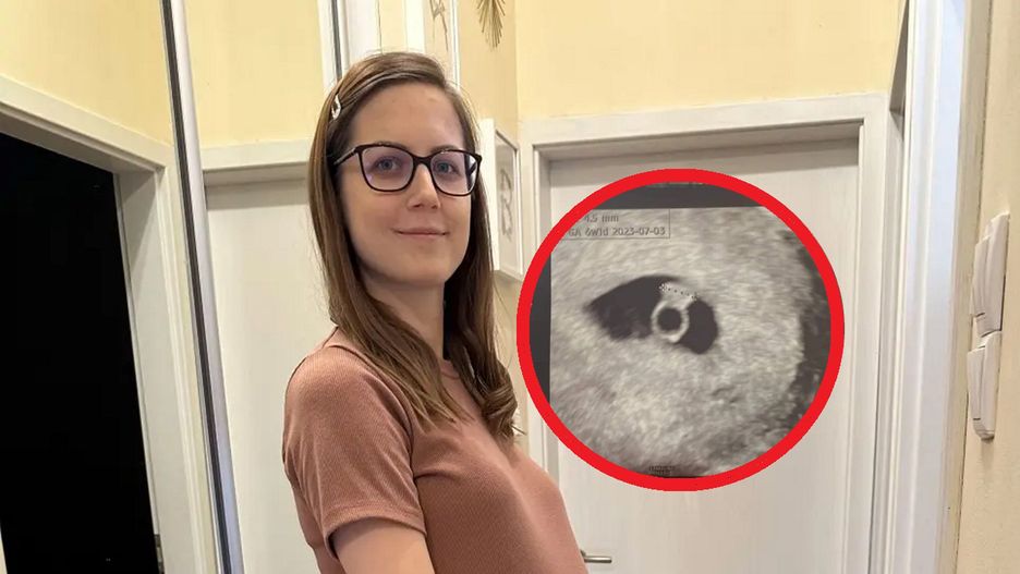 Przez lata zmagała się z bolesnymi miesiączkami. Po latach wyszło na jaw, że ma dwie pochwy