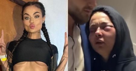 Zusje pokazuje, jak WYGLĄDA JEJ ZMASAKROWANA TWARZ 10 dni po walce: "Nie wyglądam najlepiej" (FOTO)