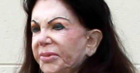 Jackie Stallone: Operacje plastyczne zdeformowały jej twarz