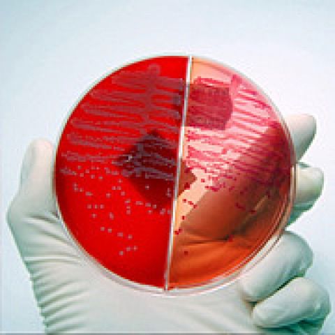 Niebezpieczna bakteria E. coli