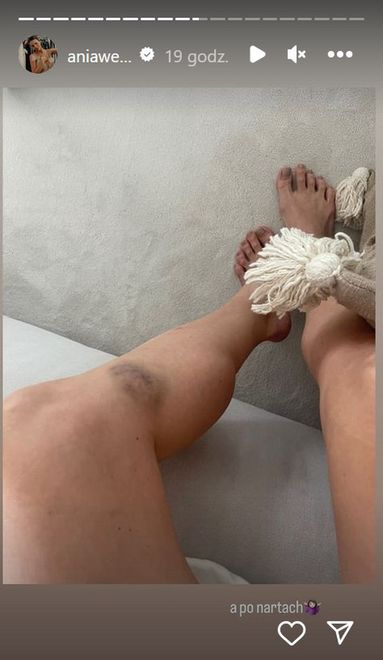 Ania Wendzikowska miała wypadek na nartach