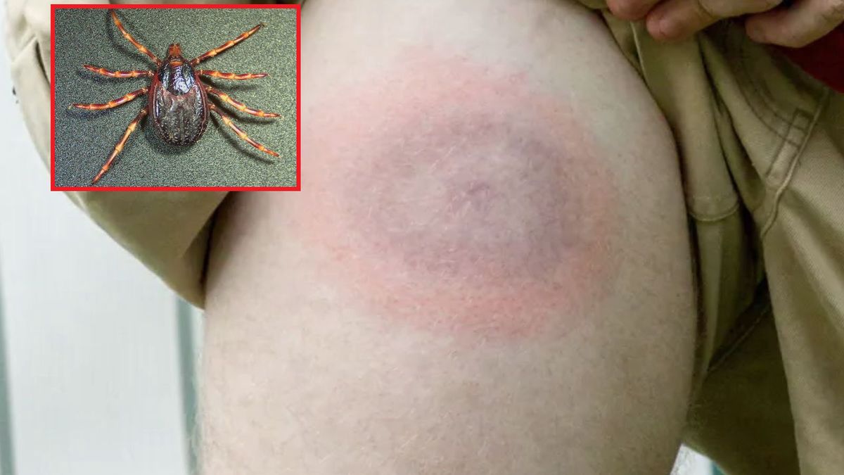 Apel w sprawie gigantów z Afryki. Naukowcy proszą o wysyłanie kleszczy do badań