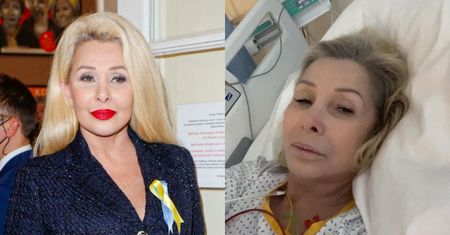 Aldona Orman publikuje zdjęcie swojego TĘTNIAKA oraz wyznaje "Żyję i czuję się dobrze" (FOTO)
