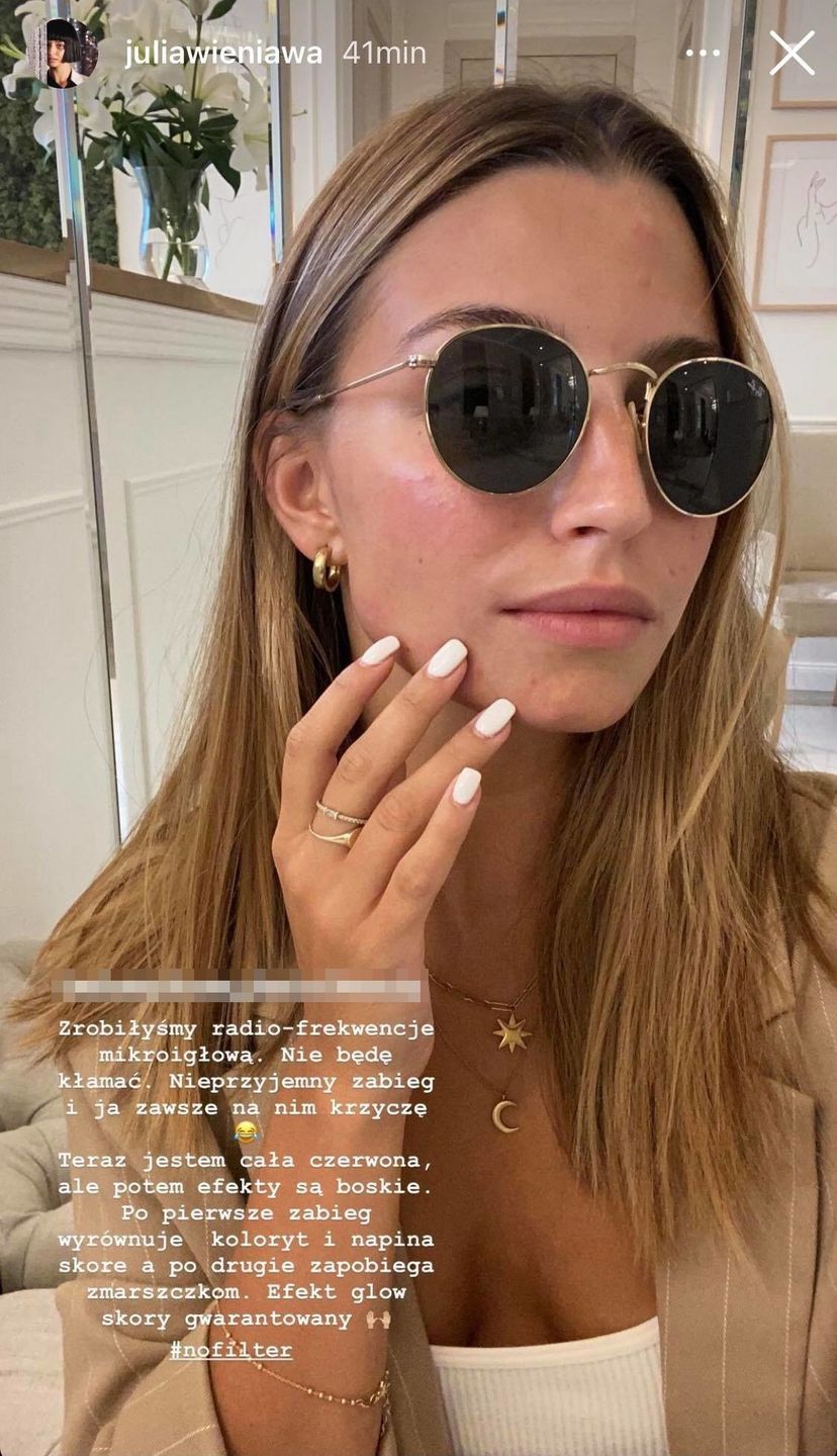 Julia Wieniawa pokazuje "renowację twarzy" po wakacjach z Nikodemem 