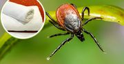 Masz kleszcze w ogrodzie? Banalny test szybko pomoże to stwierdzić
