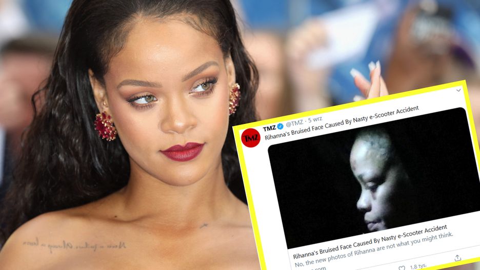 Rihanna pokazała się na mieście z pokiereszowaną twarzą