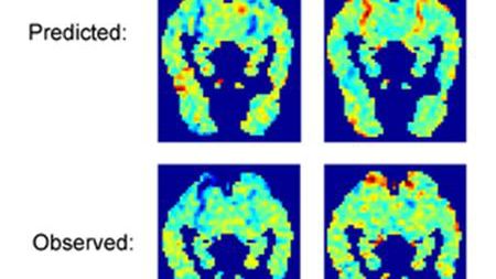 Komputer widzi słowa w mózgu 1