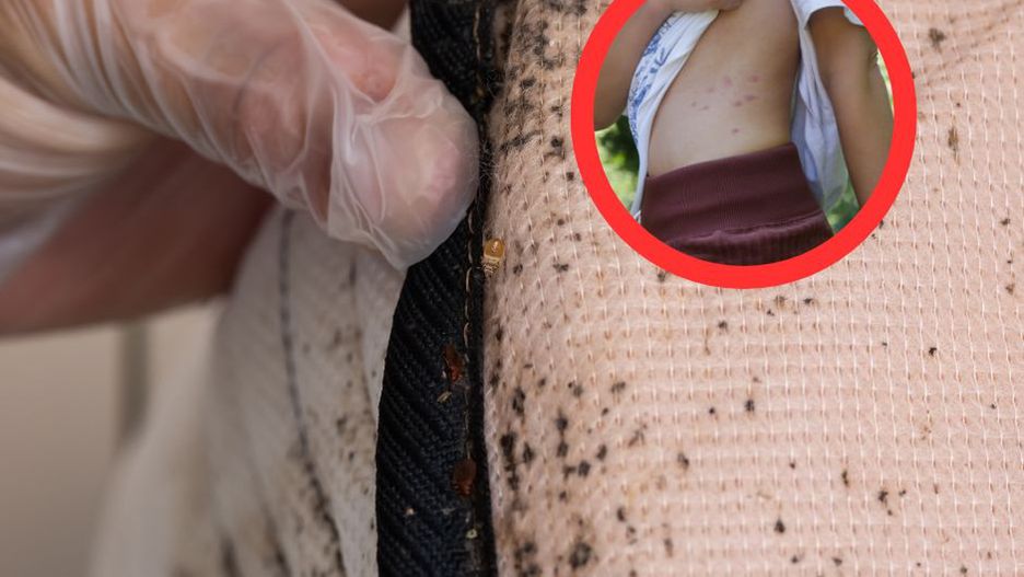 Ich obecność zauważysz na skórze po przebudzeniu. Pasożyty są szczególnie groźne dla dzieci