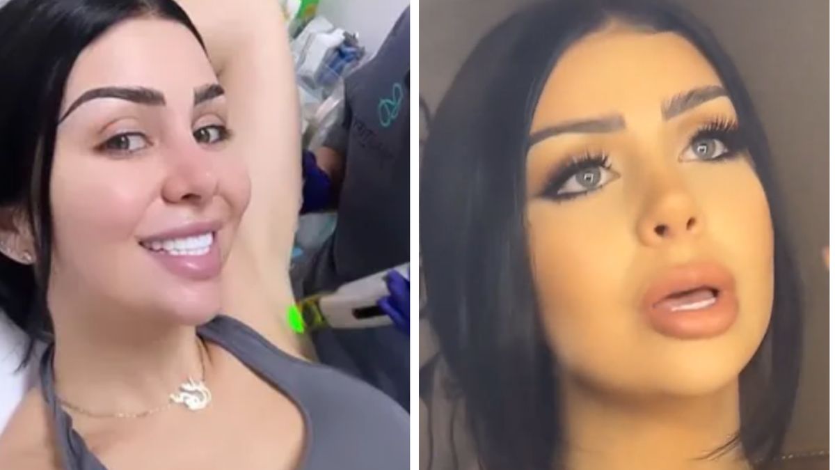 Zrobiła "tureckie zęby". Bardzo żałuje tej decyzji 