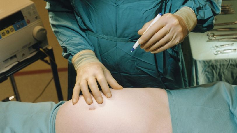 Choć upiększają, wykonasz je na NFZ. Możesz zaoszczędzić kilkadziesiąt tysięcy złotych