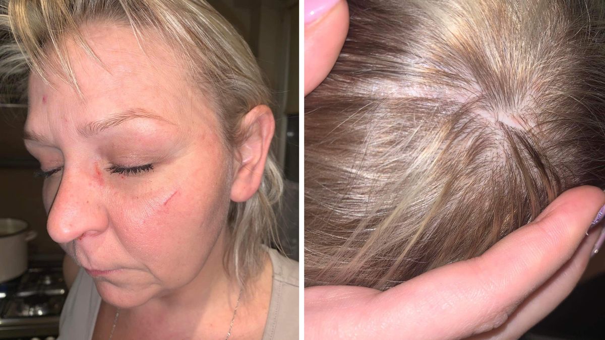 Mieszkanka Płocka twierdzi, że została pobita przez lekarkę na terenie Wojewódzkiego Szpitala Zespolonego w Płocku.