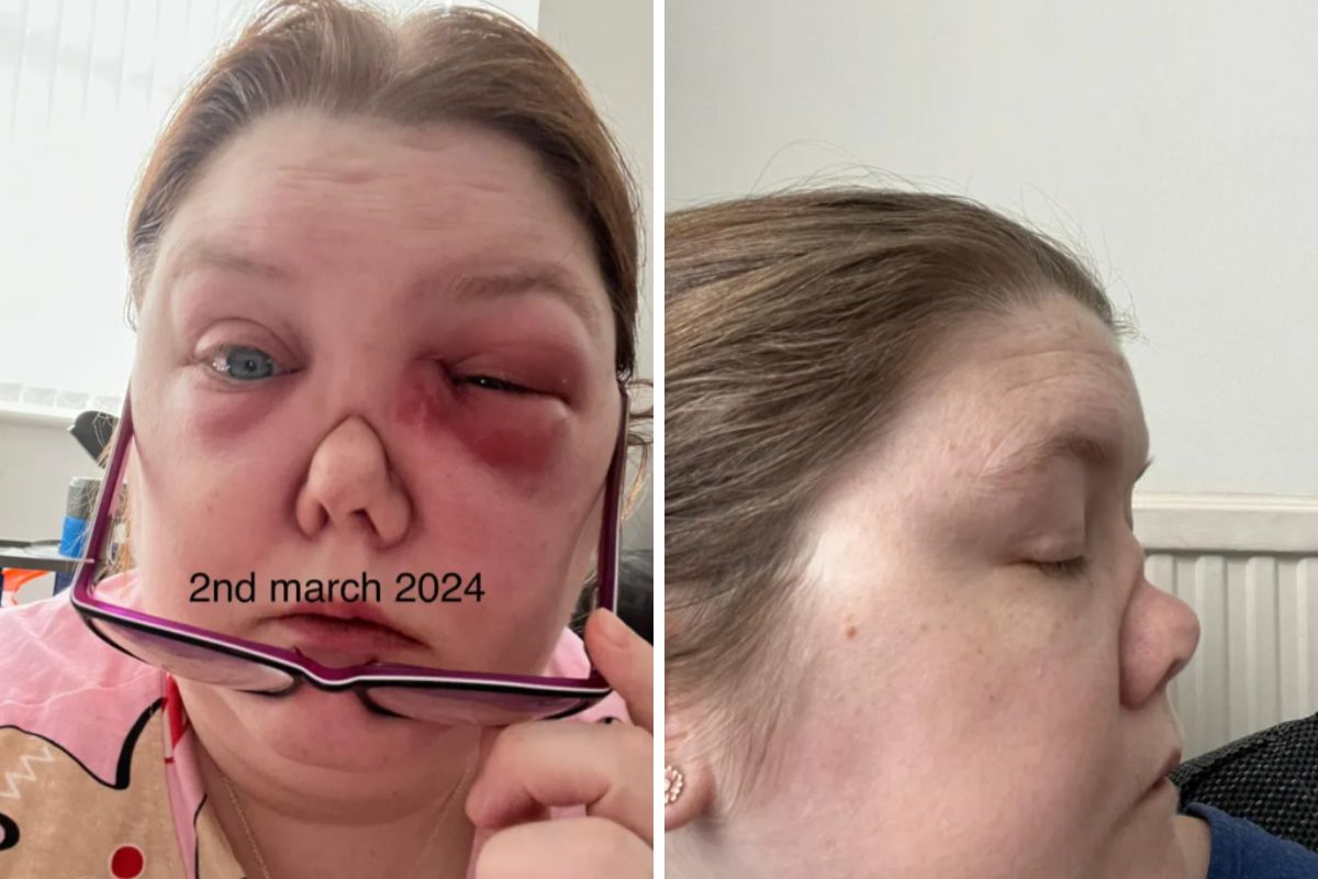 Amanda zmaga się z rzadkim schorzeniem