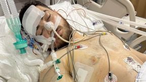 Koszmarny wypadek. Przez tydzień był w śpiączce. Trwa zbiórka dla 25-letniego sportowca