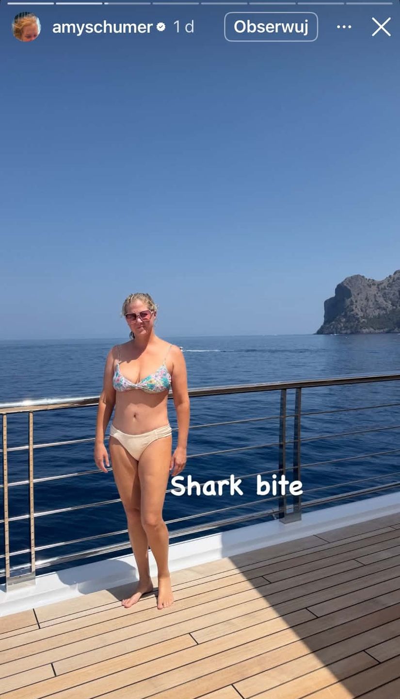 Amy Schumer