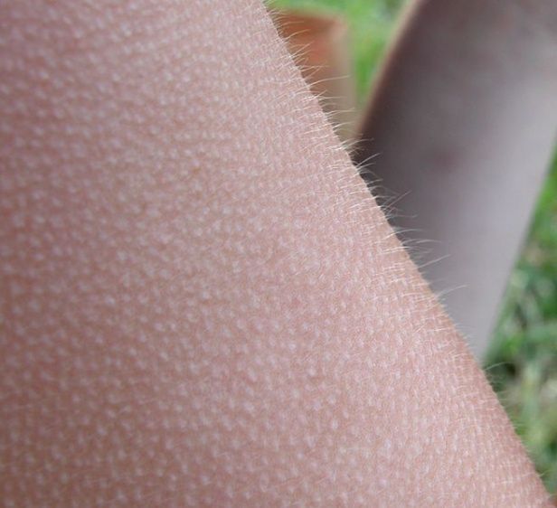 10 niezwykłych części naszego ciała, które uwielbiał Darwin 7