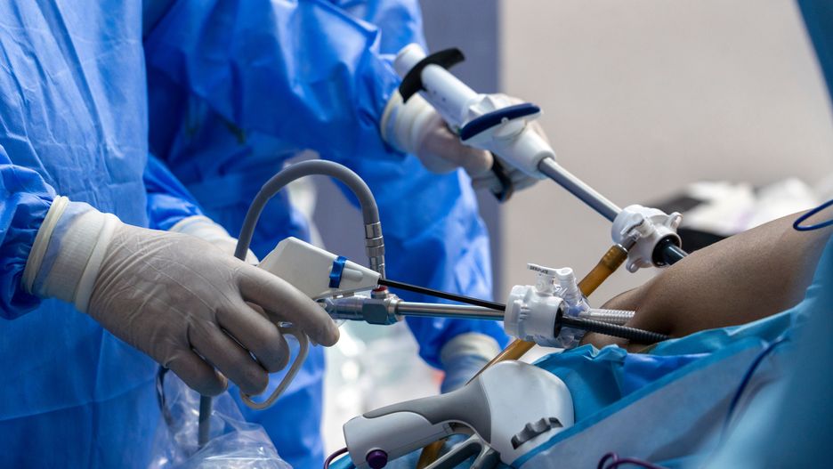 laparoskopia/ ilustracja