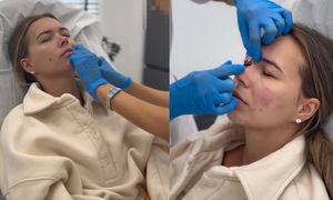 Sandra Kubicka cierpi w imię urody. Zafundowała sobie BOTOKS i nie tylko... Heroska? (WIDEO)