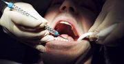 Turystyka dentystyczna Polaków. Tu jeżdżą po plomby za 50 zł