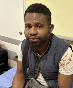 Dostawca pizzy pobity w Lublinie. "Kopali, skakali mu po głowie"