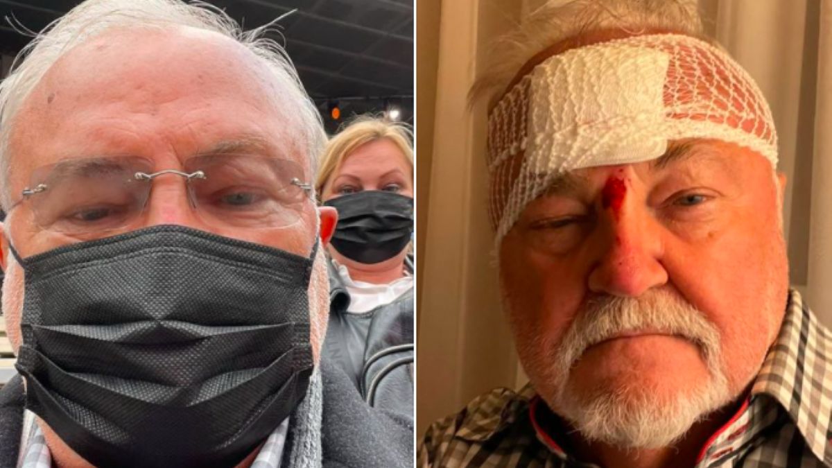 Andrzej Kosmala opisał swój wypadek na koncercie