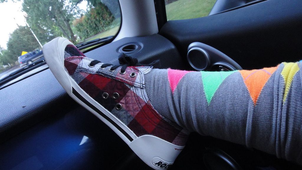 Modzele to bolesna dolegliwość stóp