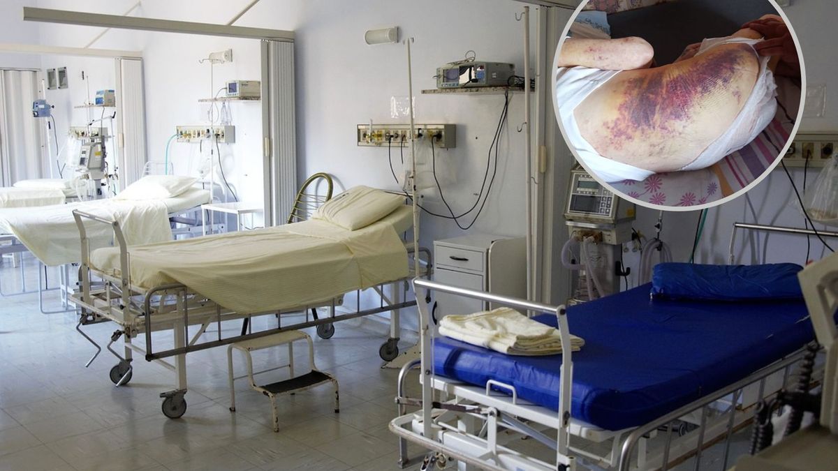 Kobieta oskarża szpital w Poznaniu i publikuje szokujące zdjęcia ojca po operacji